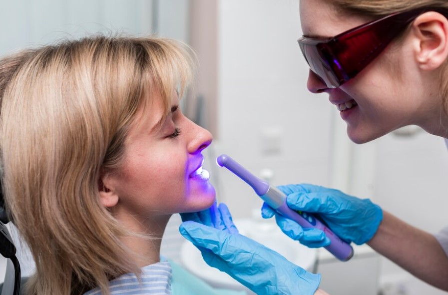 Dental Sealants